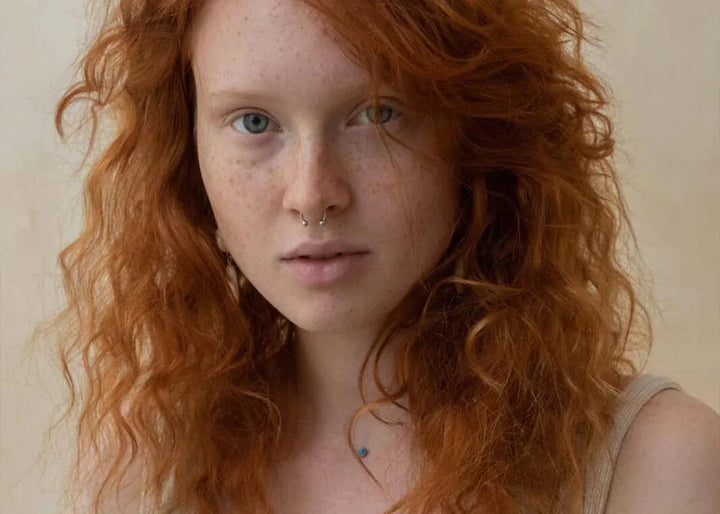 MELASMA/PIGMENTATION