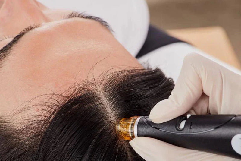 Keravive Scalp Treatment